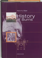 Omslag van History of burns