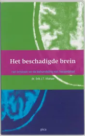 Omslag van Het beschadigde brein