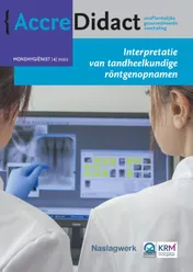 Omslag van Interpretatie van tandheelkundige röntgenopnamen