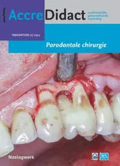 Omslag van Parodontale chirurgie