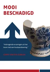 Omslag van Mooi beschadigd