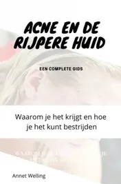 Omslag van Acne bij volwassenen