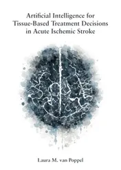 Omslag van Artificial Intelligence for Tissue-Based Treatment Decisions in Acute Ischemic Stroke