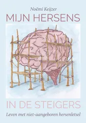 Omslag van Mijn hersens in de steigers