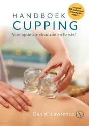 Omslag van Handboek cupping