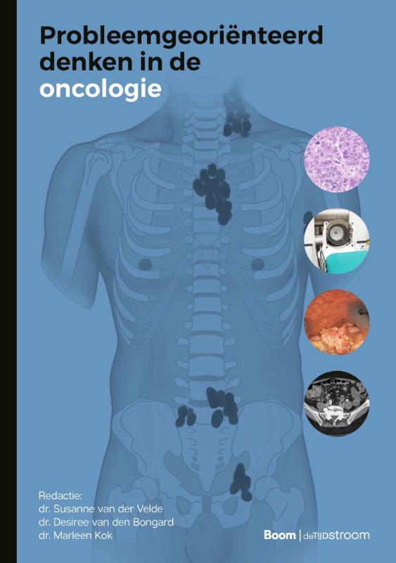 Omslag van Probleemgeoriënteerd denken in de oncologie