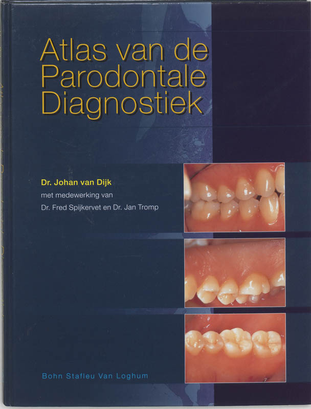 Omslag van Atlas van de parodontale diagnostiek