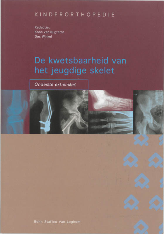 Omslag van De kwetsbaarheid van het jeugdige skelet: onderste extremiteit