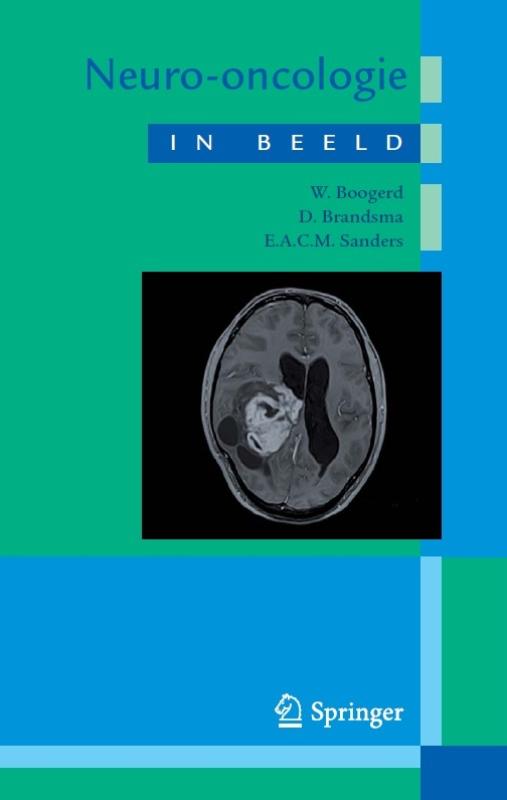 Omslag van Neuro-oncologie in beeld