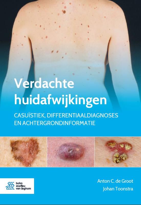 Omslag van Verdachte huidafwijkingen