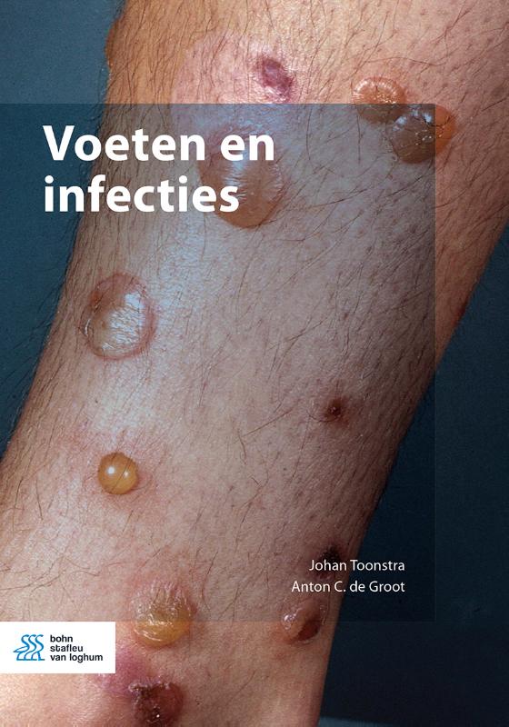 Omslag van Voeten en infecties