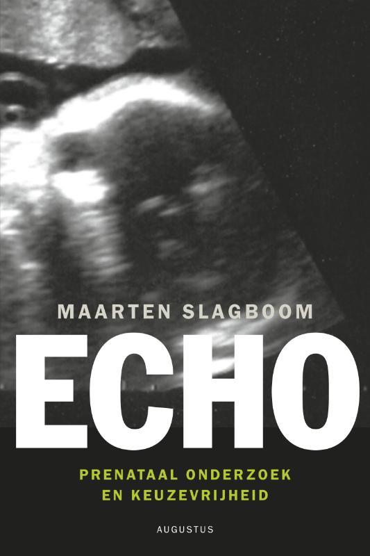 Omslag van Echo