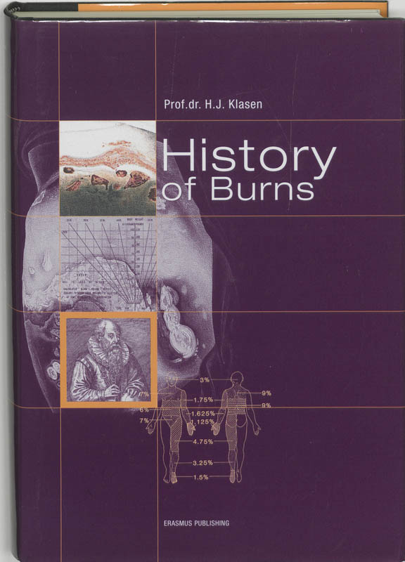 Omslag van History of burns