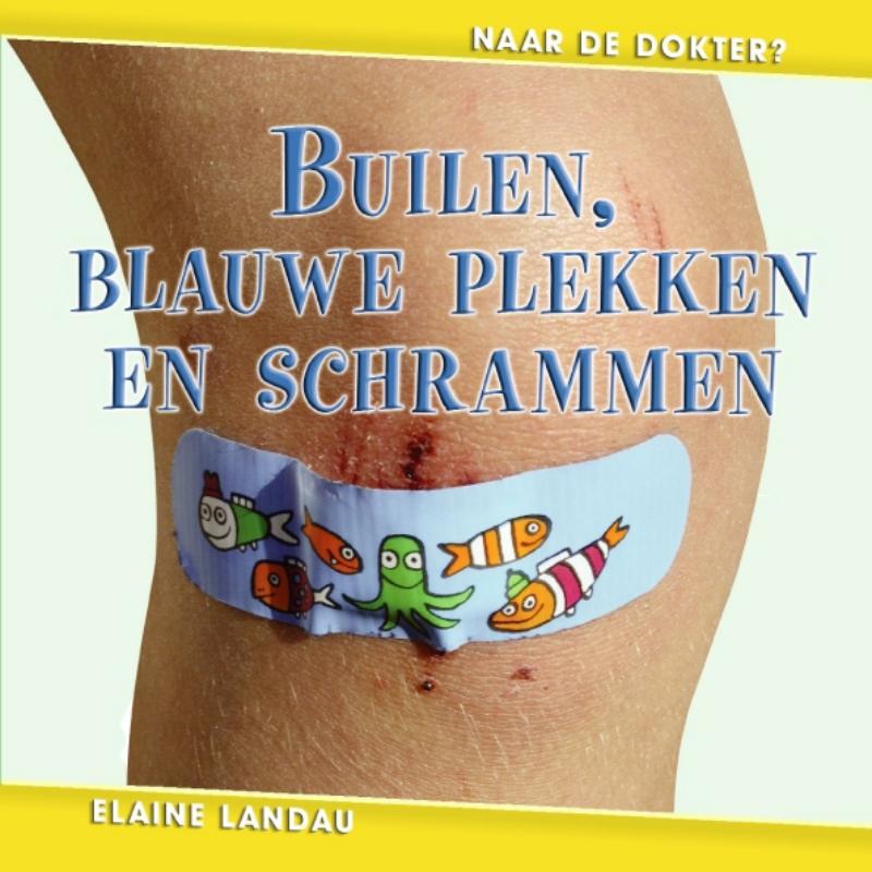 Omslag van Builen, blauwe plekken en schrammen