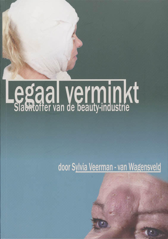 Omslag van Legaal verminkt