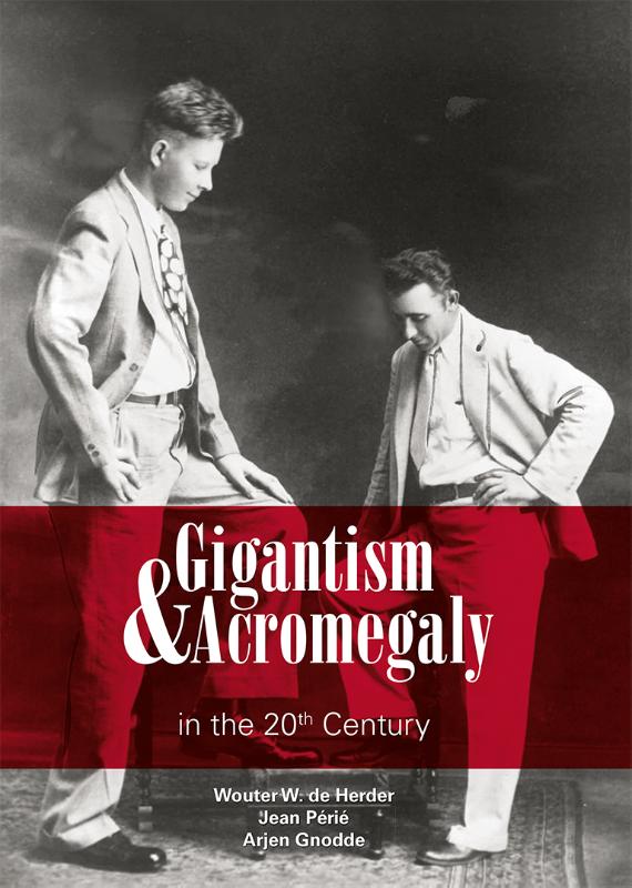 Omslag van Gigantism & Acromegaly