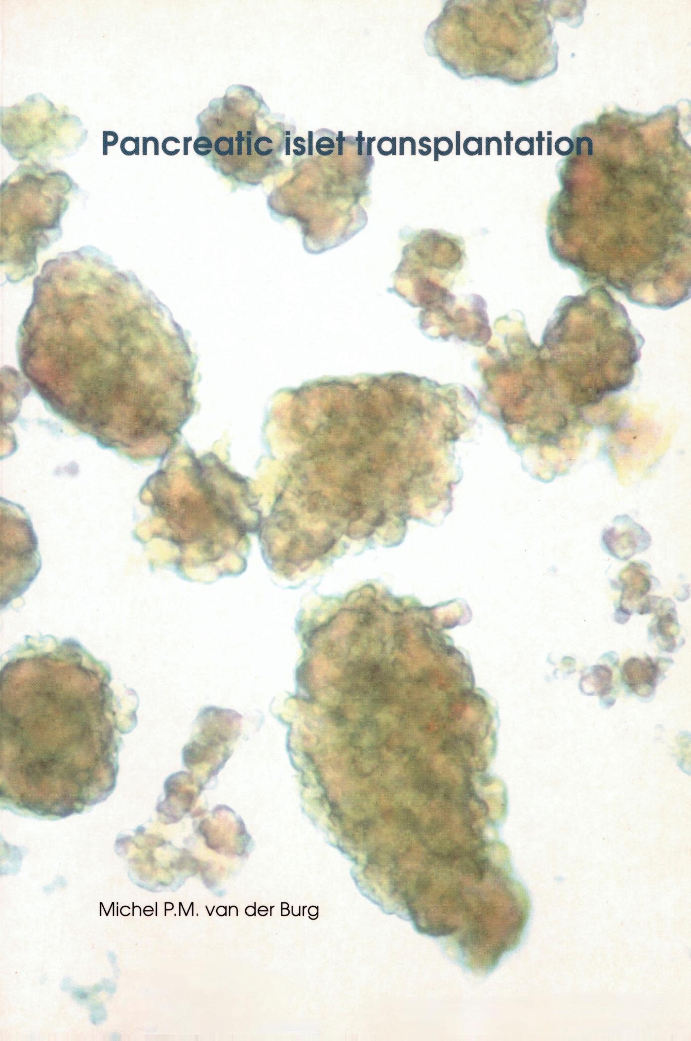 Omslag van Pancreatic islet transplantation