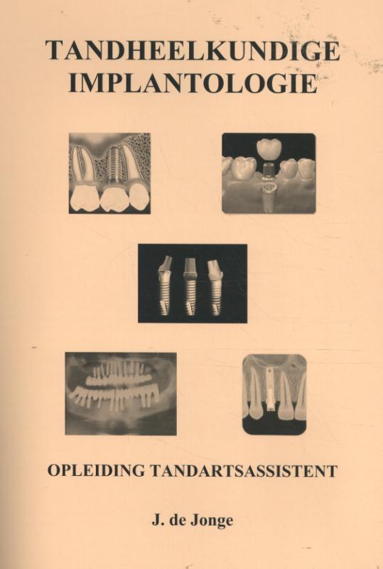 Omslag van Tandheelkundige Implantologie