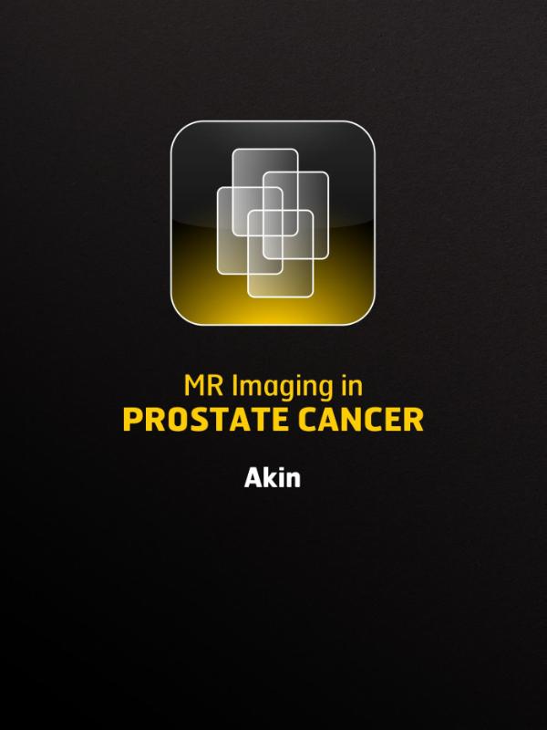 Omslag van Mr imaging in prostate cancer