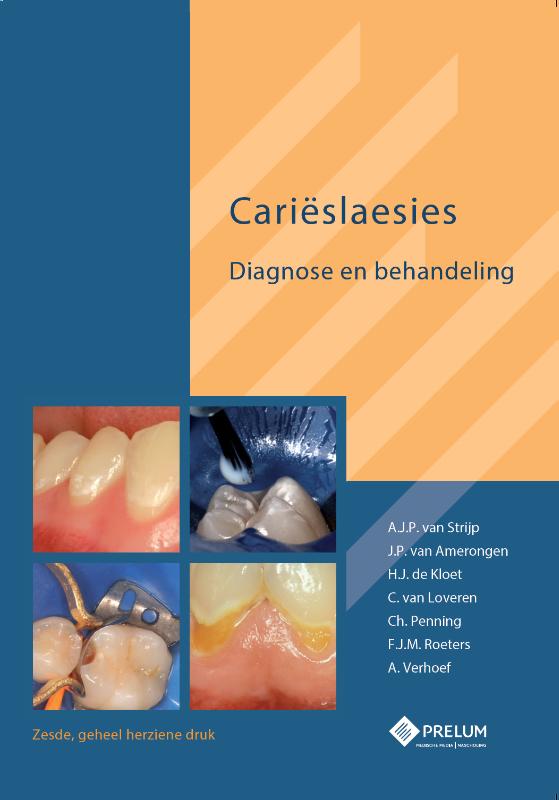 Omslag van Carieslaesies