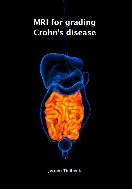 Omslag van MRI for grading crohn's disease