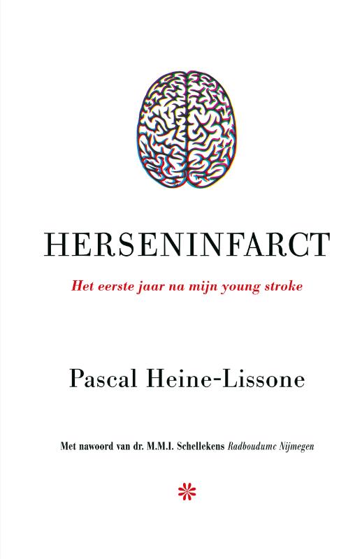 Omslag van Herseninfarct