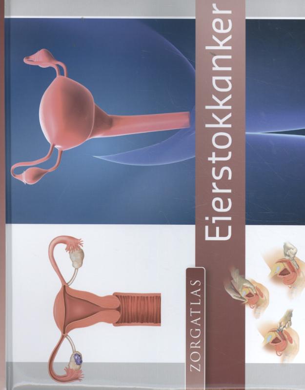 Omslag van Zorgatlas Eierstokkanker